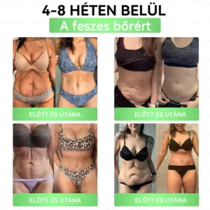 Glumasetide 8az 1-ben Karcsú és EgészségesNano Mikrotűs Tapasz - Image 6