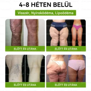 Glumasetide 8az 1-ben Karcsú és EgészségesNano Mikrotűs Tapasz - Image 7