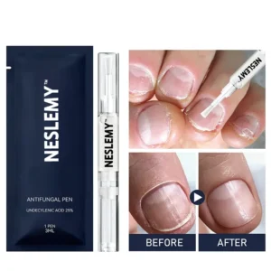 Antifungal Pen – 25% Undecylenic Acid Treatment for Athlete’s Foot &Skin Fungus - Image 3