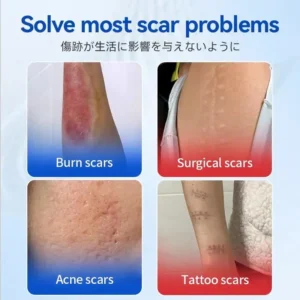 Silicone Scar Gel - Image 2