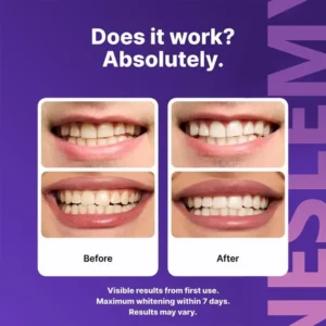 Purple Whitening Strips - Image 2