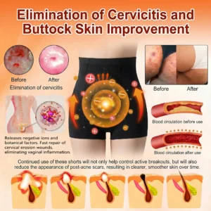 30-Min All-in-One Micro-Particle Fat-Burning Shorts - Image 13