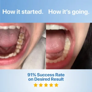 QIAWI Fluoride-Free Hydroxyapatite Tooth Armor Essence & Enamel Repair - Image 2