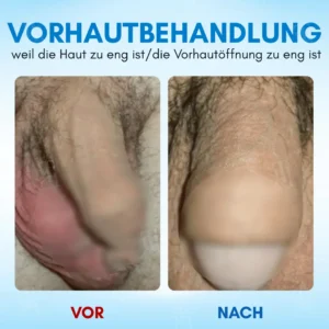 Gel ：Zellaktives Bio-Tech Gel für Elastizität & Systemische Vitalität - Image 2