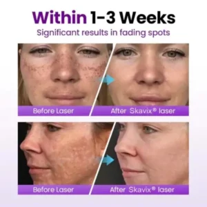 SpotRefiner Probiotic Shield Serum - Image 8