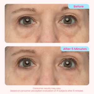 Instant Eye Tightening Gel - Image 4