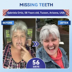 Tideglusib Fast‑Dissolving Tooth & Gum Repair Oral Strips - Image 2