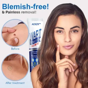 Wart Removal Ointment - Image 4