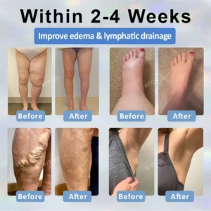 Black Cumin Edema Soothing Herbal Cream - Image 3