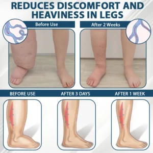 Black Cumin Edema Soothing Herbal Cream - Image 6