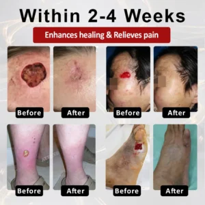 GlucoseGuard Skin Rescue Cream - Image 2