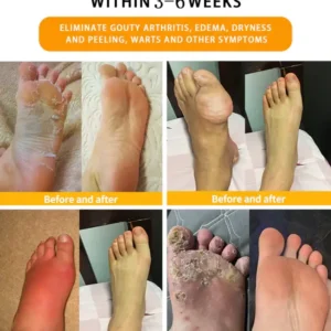 30-Herb Slimming & Detox Foot - Image 7