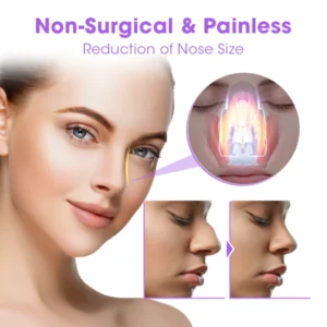 NosaNova Nose Sculpting Device - Image 2