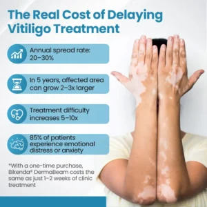 DermaBeam Vitiligo Therapy Device - Image 10