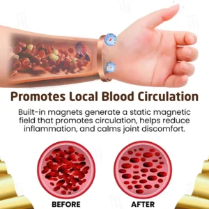 Arthritis Pain Gone - Magnetic Acupressure Bracelet - Image 8