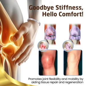 Arthritis Pain Gone - Magnetic Acupressure Bracelet - Image 9
