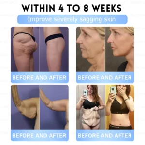 Slim & Firm Nano Microneedle Patch with Collagen - Image 8