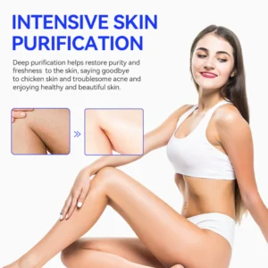 Keratosis Pilaris & Akne Behandlung Körper Erfrischende Creme - Image 2