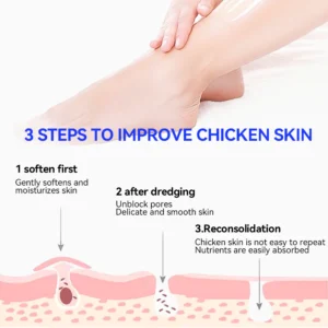 Keratosis Pilaris & Akne Behandlung Körper Erfrischende Creme - Image 4