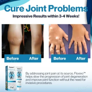 Hyaluronic Acid Joint Repair Cream - Image 2