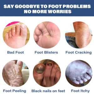 Medical grade fungal nail fungus foot spray - Image 6