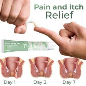 German Hemorrhoid Soothing Cream - Image 3