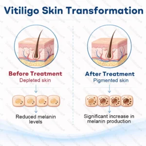 Piperine Vitiligo Repigmentation Spray - Image 2