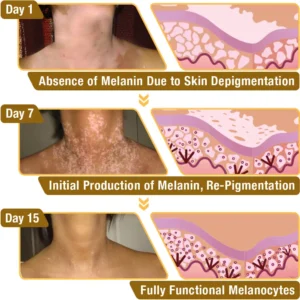 VitiGO Bee Venom Treatment Cream - Image 7