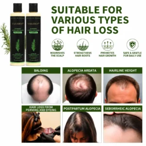 Organic Rosemary Hair Growth Shampoo - Image 3