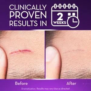Advanced Scar Gel - Image 4
