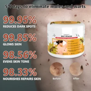 Bee Venom Mole and Wart Treatment Cream - Image 4