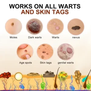 Bee Venom Mole and Wart Treatment Cream - Image 5