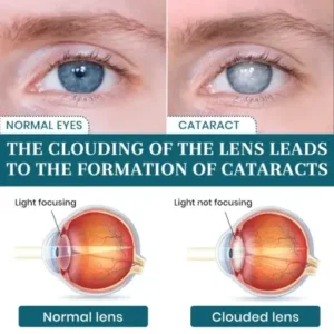 OptiFusion Nano Eye Drops Serum - Image 4