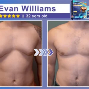 NanoMedix Gynecomastia Chest Fatburn & Firm Patch - Image 2