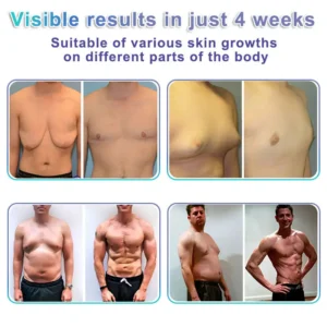 NanoMedix Gynecomastia Chest Fatburn & Firm Patch - Image 4