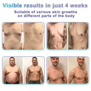 NanoMedix Gynecomastia Chest Fatburn & Firm Patch - Image 5