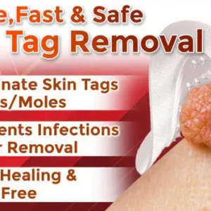 MicroNeedle Botanic Skin Tag Removal Patch - Image 2
