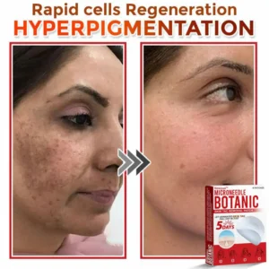 MicroNeedle Botanic Skin Tag Removal Patch - Image 7