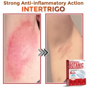 MicroNeedle Botanic Skin Tag Removal Patch - Image 8