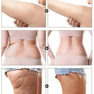 Slimoly Anti Cellulite Massage Oil - Skin Tightening Moisturizing - Image 9