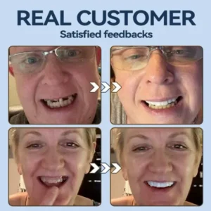 – MedicalFit Adaptive Dentures – Suitable for all mouth shapes perfect fit - Image 10