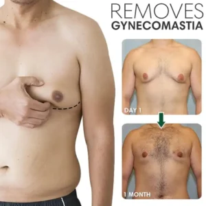 SoliPac Gynecomastia Reduction Ointment - Image 3