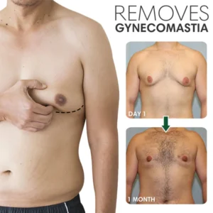 Gynecomastia Tightening Ginger Cream - Image 3