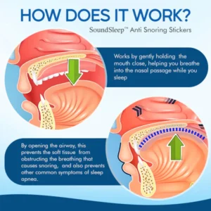 Anti Snoring Stickers - Image 4