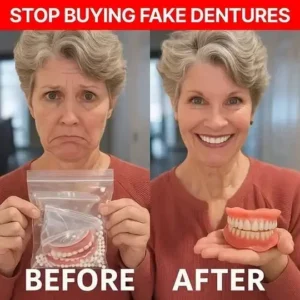 Custom-Fit Dentures - Image 10