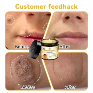 Bee Venom Multi-Action Skin Repair Cream - Image 7