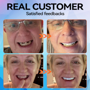 Denture Silicone Kit - Image 10