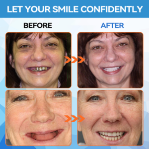 Denture Silicone Kit - Image 8
