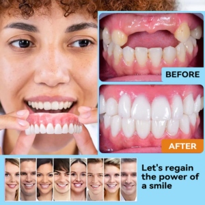 Denture Silicone Kit - Image 9