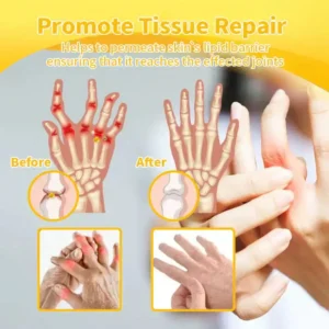 Lidocaine Arthritis Pain Relief Healing Gel - Image 12